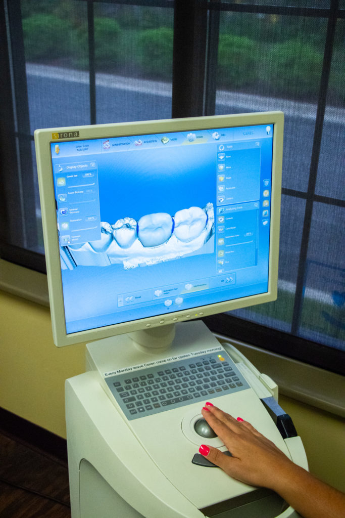 Digital scanners allow precise measurements for dental crowns for the best fit. 