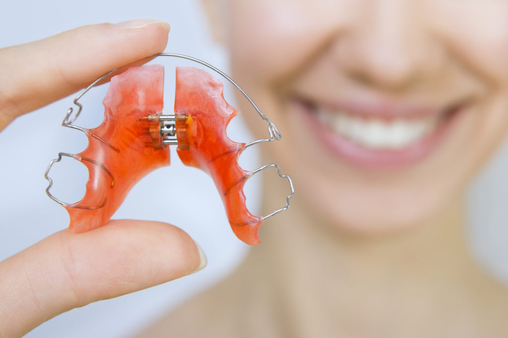 Smiling girl holding a retainer which is a typical after braces therapy. 