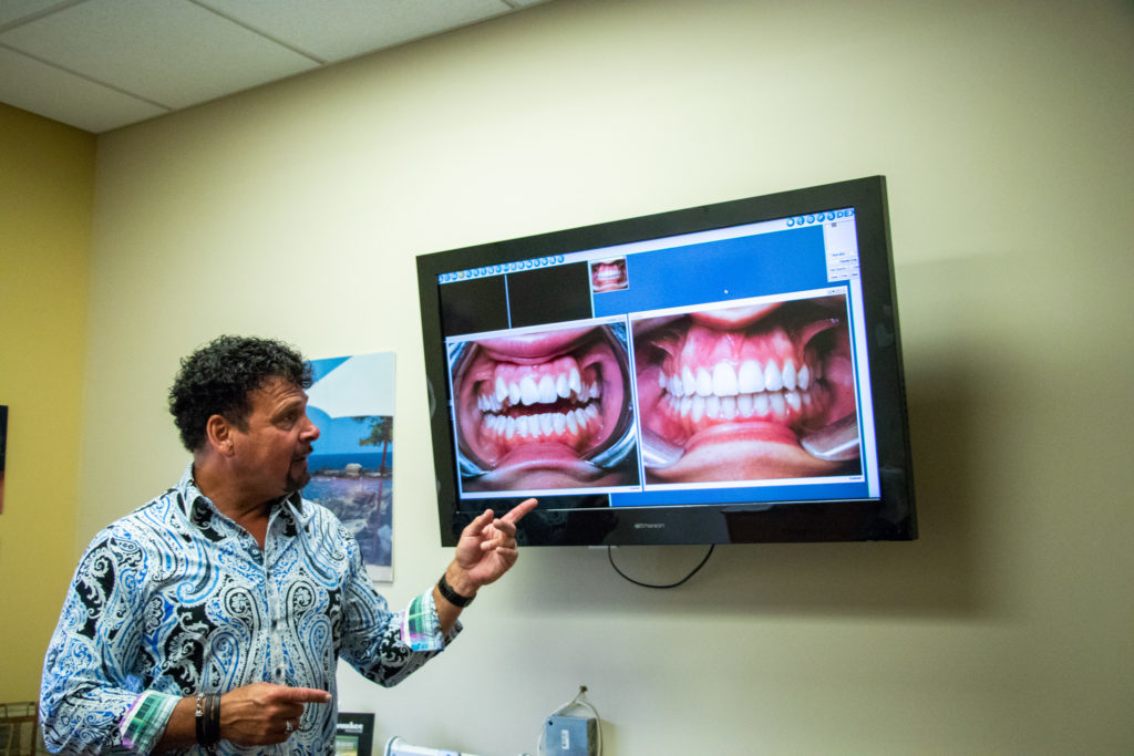 Dr. Cigno shows a before and after photo of a smile that benefited from Fast Braces treatment. 