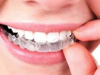 invisalign near west allis